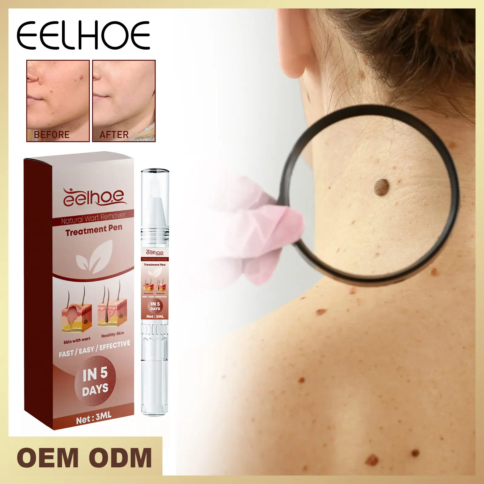 Wart Pen Deep Cleansing Mole Flesh Repair Smoothing Facial M