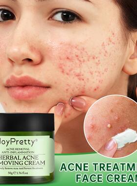 Acne Face Cream Herbal Pimple Scar Removal Shrink Pore Oil C