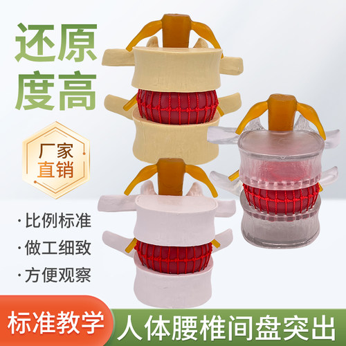 黄和模型腰椎间盘突出教学