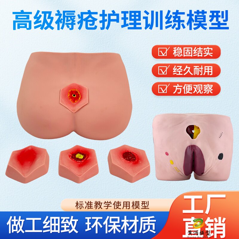 黄和模型褥疮压疮护理教具