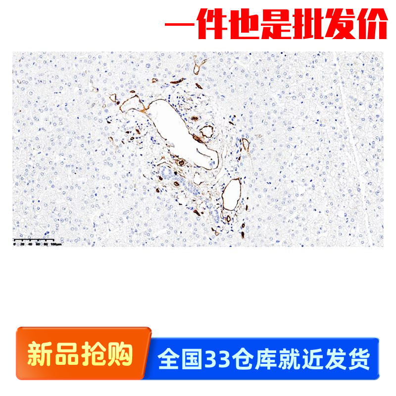 中杉金桥 ZA-0550 CD34内皮细胞标记 抗体试剂（免疫组织化学）