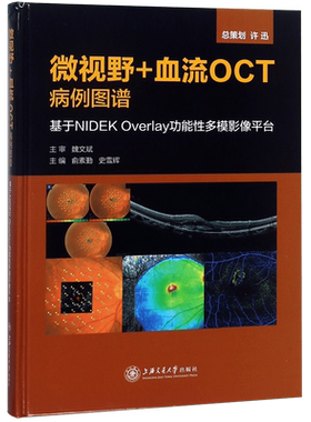 微视野+血流OCT病例图谱(基于NIDEK Overlay功能性多模影像平台)(精)