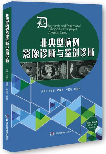 非典型病例影像诊断与鉴别诊断(精)