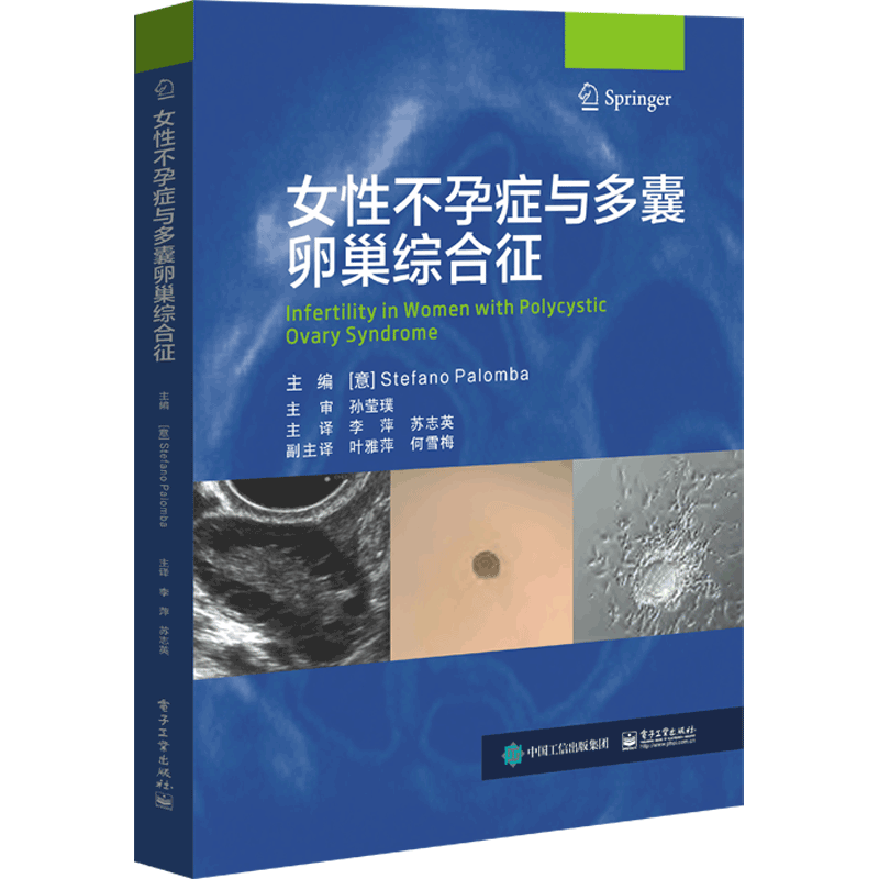 女性不孕症与多囊卵巢综合征