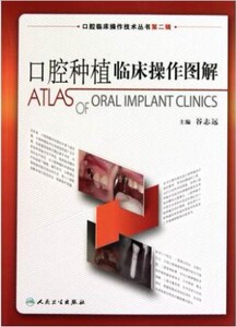 T1正版医学书籍大全 口腔种植临床操作图解/口腔临床操作技术丛书 正版图书 谷志远 科技9787117129831
