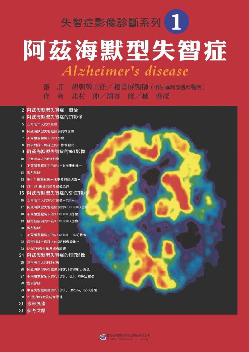 【现货】台版 失智症影像诊断系列01 阿兹海默型失智症影像图片介绍基础失智症影像诊断疾病百科知识大全医疗保健书籍