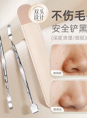 黑头铲刮粉刺针手动挤痘痘工具