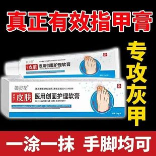 御灵花医用创面护理软膏敷料灰指甲增厚抑菌亮甲甲沟炎止痒膏正品