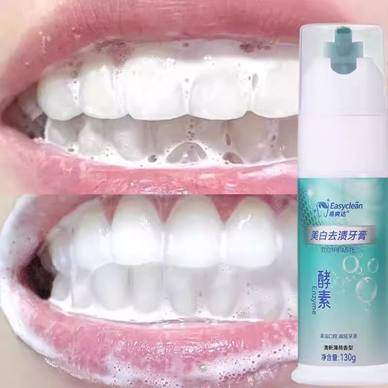 【日本洗牙技术】白牙神器唇红齿白牙齿去黄去烟渍茶渍结石男女