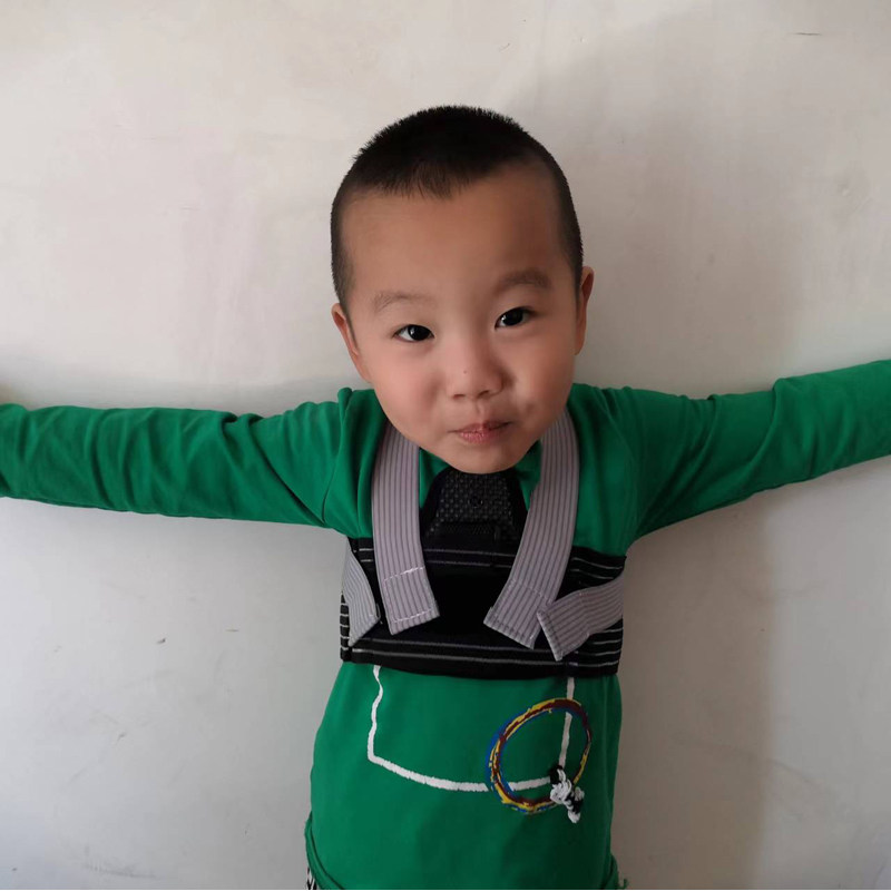 胸部幼儿儿童鸡胸骨矫正器