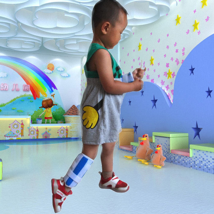 幼儿童外固定支具胫腓骨折夹板小腿护具钢板矫形康复术后支架包邮