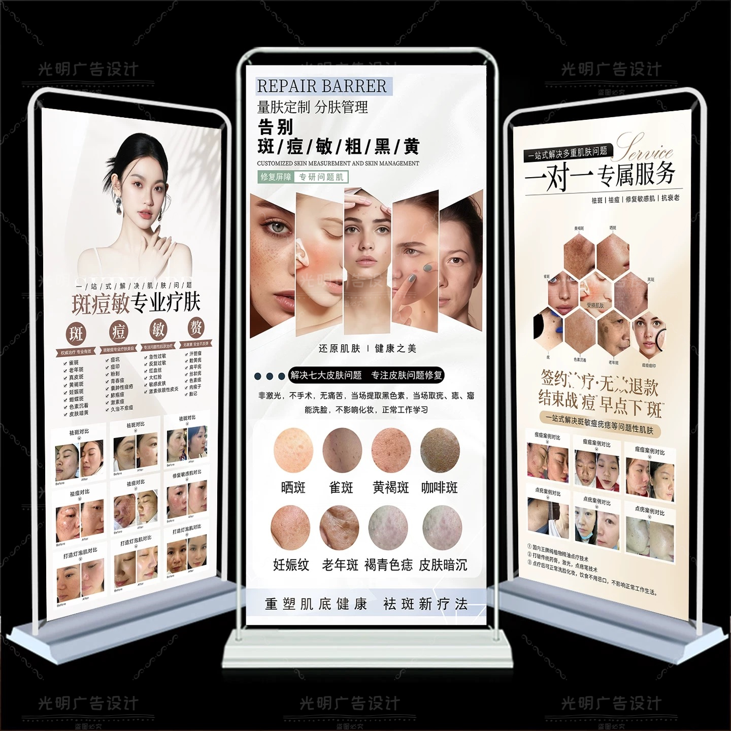 斑敏痘问题肌肤修复宣传展架皮肤写真/海报印制