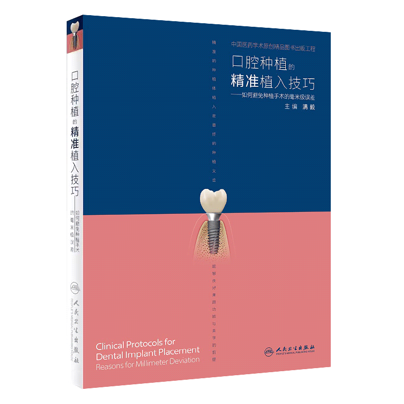 口腔种植精准技巧如何避免