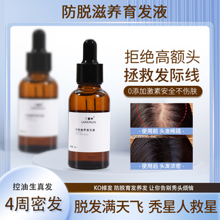 防脱滋养育发液增发密发际线or头皮精华固发强韧防掉发快速增长液