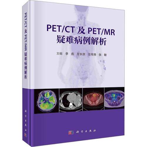 PET/CT及PET/MR疑难病例解析(精)李彪科学出版社