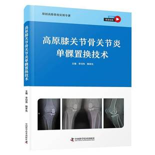 高原膝关节骨关节炎单髁置换技术李钊伟中国科学技术出版 社