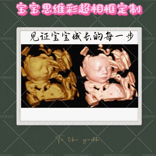 宝宝四维彩超相框冰箱贴定制孕期三维五维3D打印还原成长纪念摆台