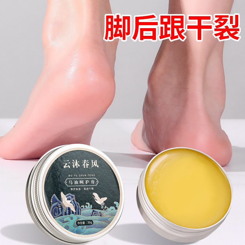 脚后跟干裂修复霜龟裂脚底开裂膏护足霜裂口冻疮去死皮滋润马油膏