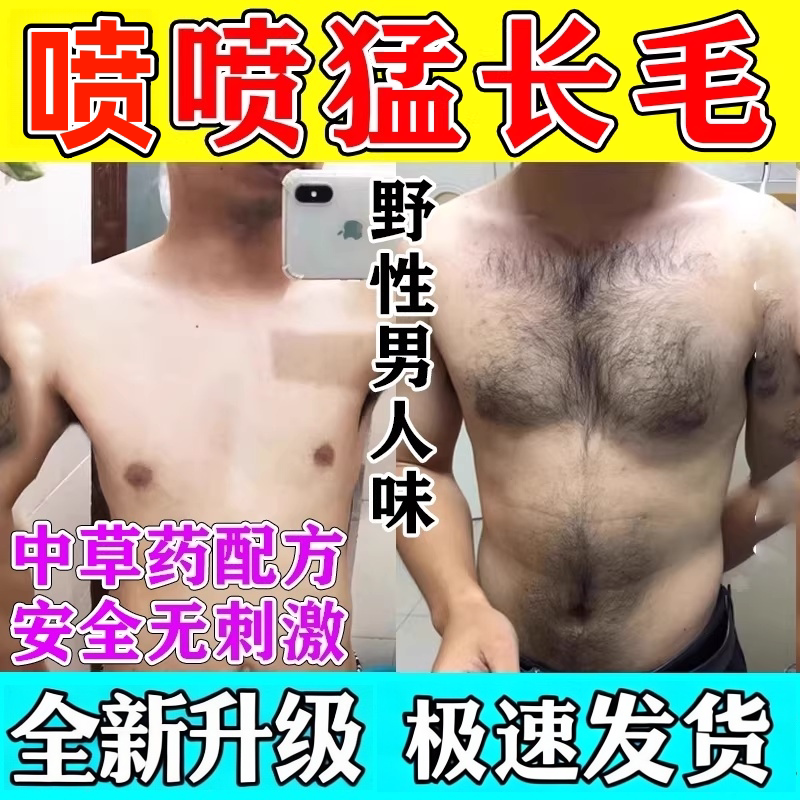 胸毛生长液浓密毛发增长液络腮胡腿毛滋养增毛膏增发际线体毛通用