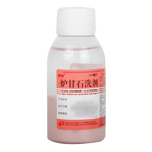 【鹏鹞】炉甘石洗剂100ml*1瓶/盒