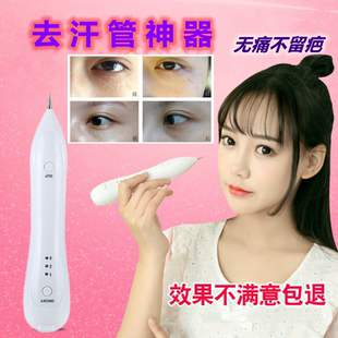 去汗管无痛不留疤汗管眼部去除神器专用膏日本去除仪器脂肪粒挑针