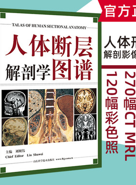 正版现货 人体断层解剖学图谱 刘树伟CT、MRI断层解刨影像彩色插图学习参考书 人体局部解剖学教程教材西医学书籍