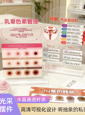 女性私密健康科普摆件卵巢保养乳晕色素管理可视化亚克力咨询展示