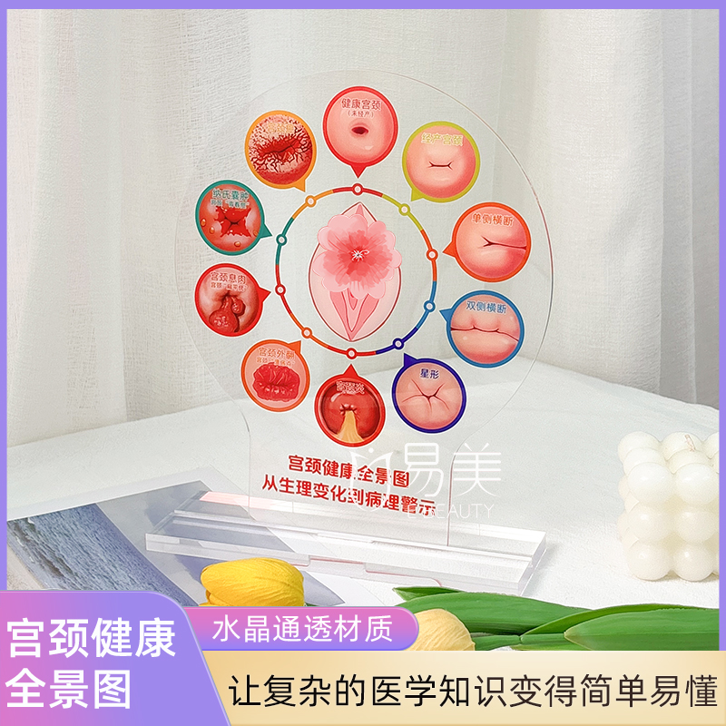 卡通宫颈健康图美容院科普宫颈知识亚克力摆件科普知识产康店