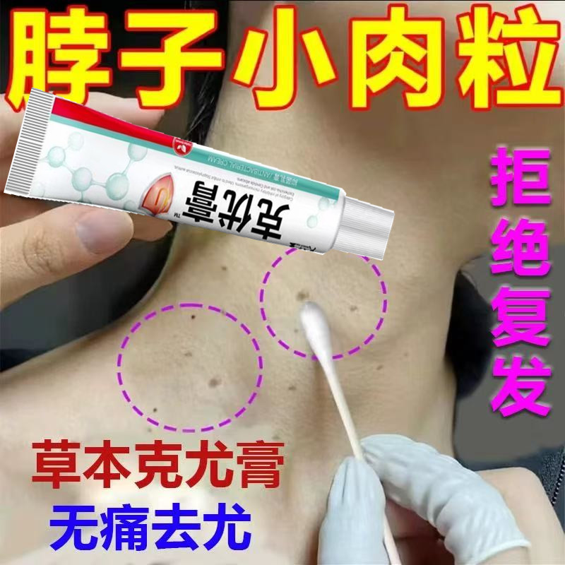 琦鸿阁克优膏去尤瘊小肉粒脖子颈部长赘皮丝状尤去除扁平尤专用膏