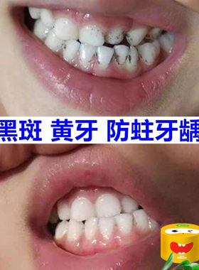儿童专用黑斑去除神器清理洗牙粉