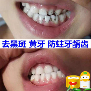 儿童洗牙粉专用护牙剂美白黄牙齿黑斑去除牙菌斑神器蛀牙牙洞清理
