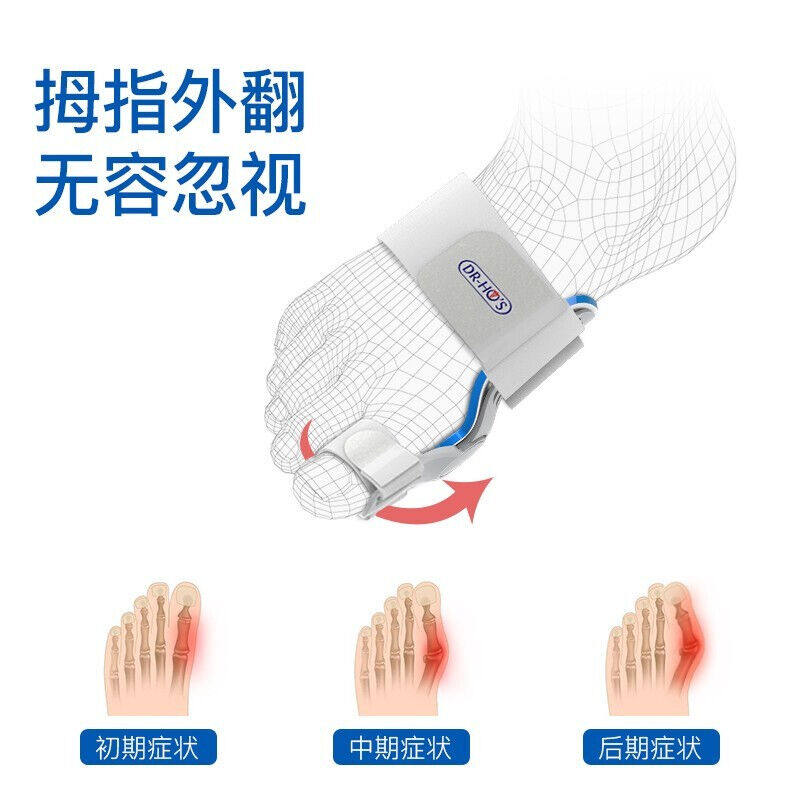 何浩明脚趾矫正器保健护具(护腰/膝/