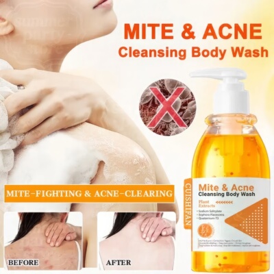 Mite &Acne Cleansing Body Wash