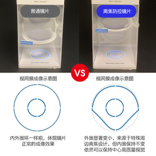 儿童青少年1.61防蓝光离焦防控绿膜高清树脂镜片学生近视防控配镜