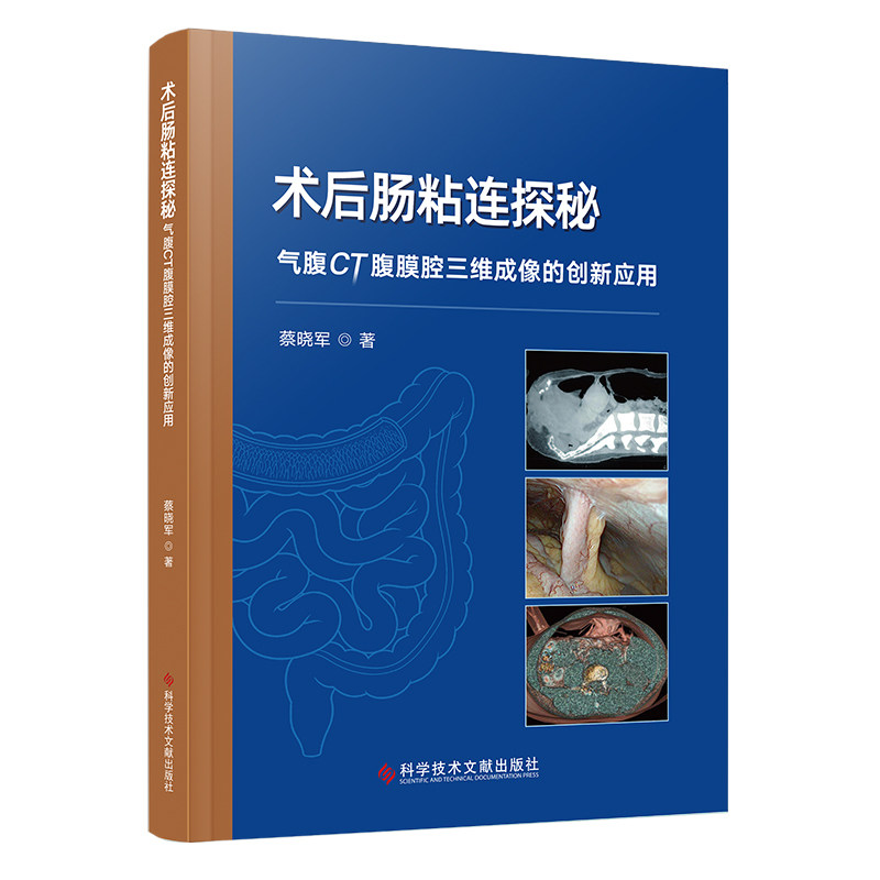 【官方正版】 术后肠粘连探秘 蔡晓军著 科学技术文献出版社 9787523531983