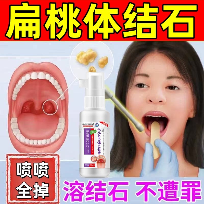 扁桃体结石去除工具隐窝冲洗器口腔有异味清理口臭漱口水神器喷剂,洗护清洁剂/卫生巾/纸/香薰,牙刷/口腔清洁工具,淘宝优惠券,粉丝福利购,淘宝优惠卷