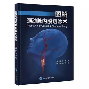 正版图解颈动脉内膜切除术 焦力群 北京大学医学出版社 宣武医院脑缺血治疗系列丛书 围术期影像学评估手术操作细节 教程教材书籍