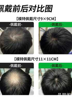 个性遮秃发片头顶头旋发缝补发片递针旋遮遮秃发片ins风