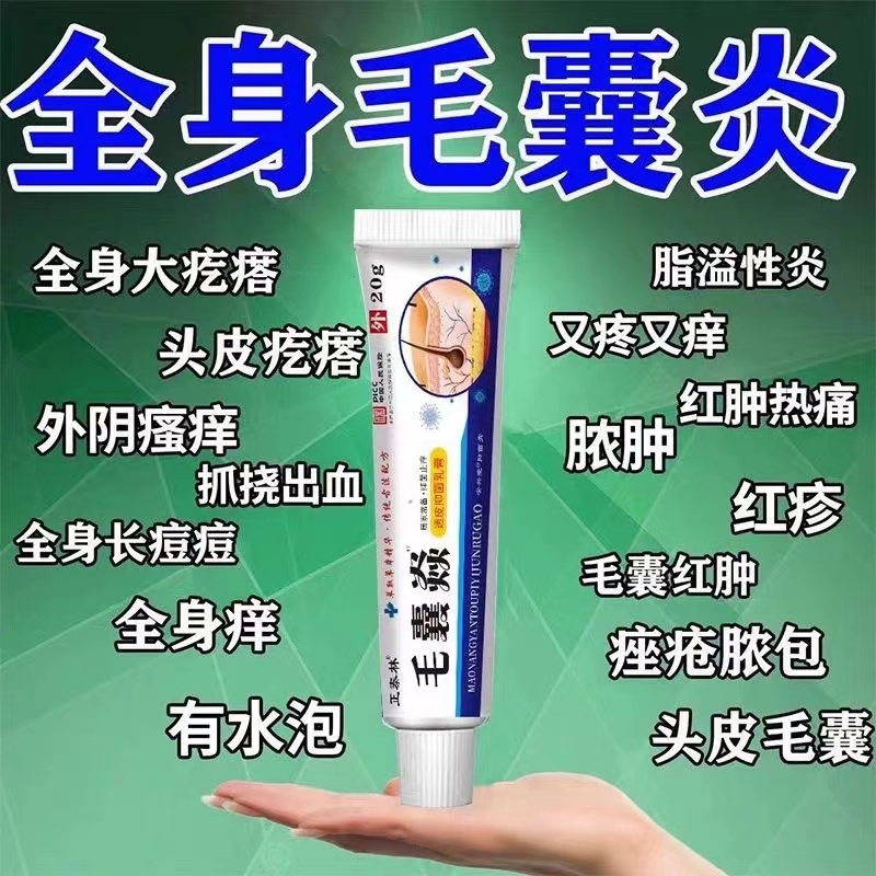 头上长痘痘脓包疙瘩头癣毛囊炎脓疮毛囊发炎堵塞抑菌止痒消炎乳膏