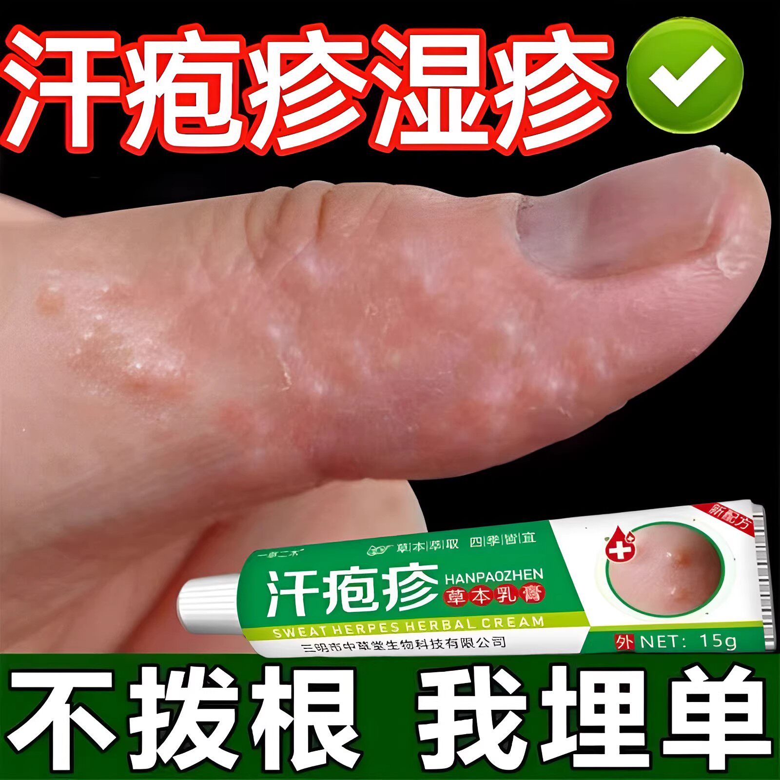 手上起小水泡汗泡疱止痒中药抑菌鹅掌风真菌感染手气湿痒疹专用膏