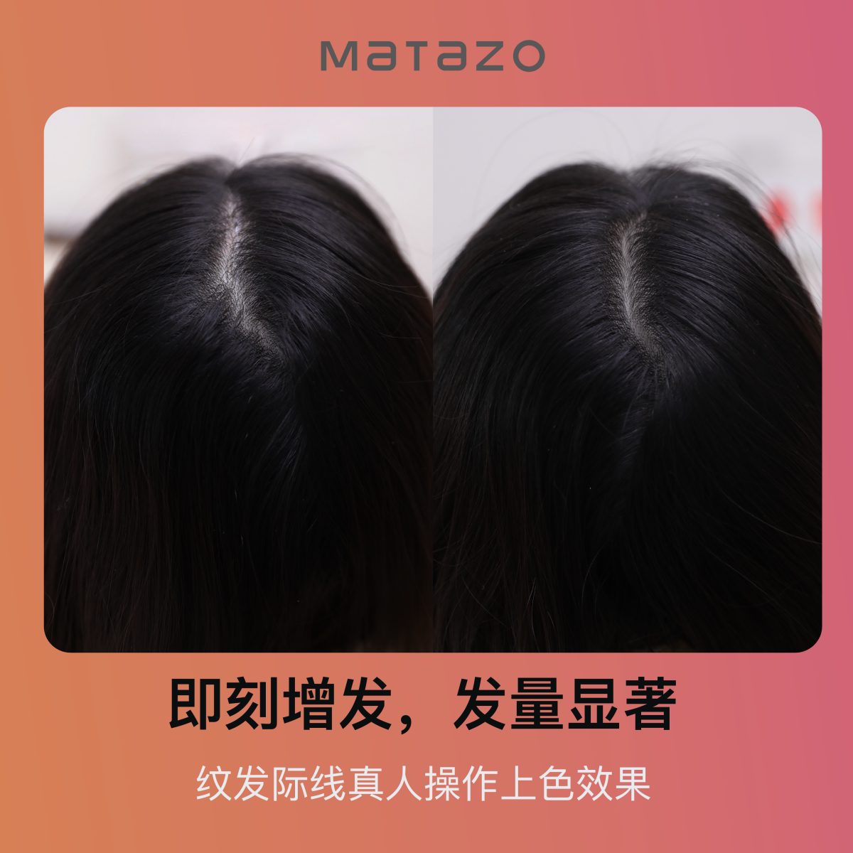 术妍单瓶纹发色料发际线发缝植物萃取正品质检无需调配液体色料