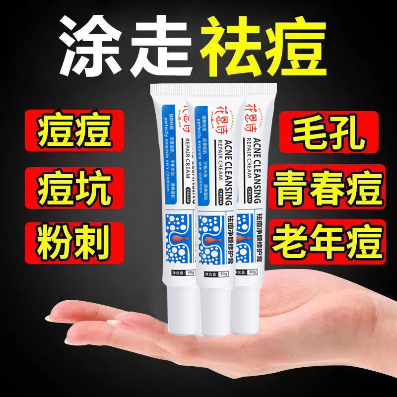 花恩诗草本舒缓膏淡化痘印闭口粉刺黑头痘坑红肿官方官网正品