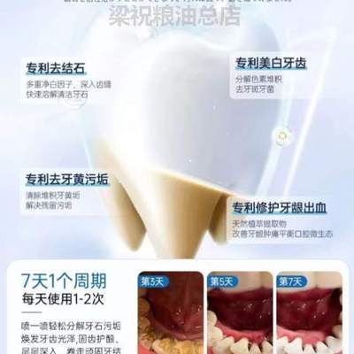 神美速效牙斑净去%结石清洁白牙烟渍污垢祛除黄牙粉牙菌斑洗牙齿