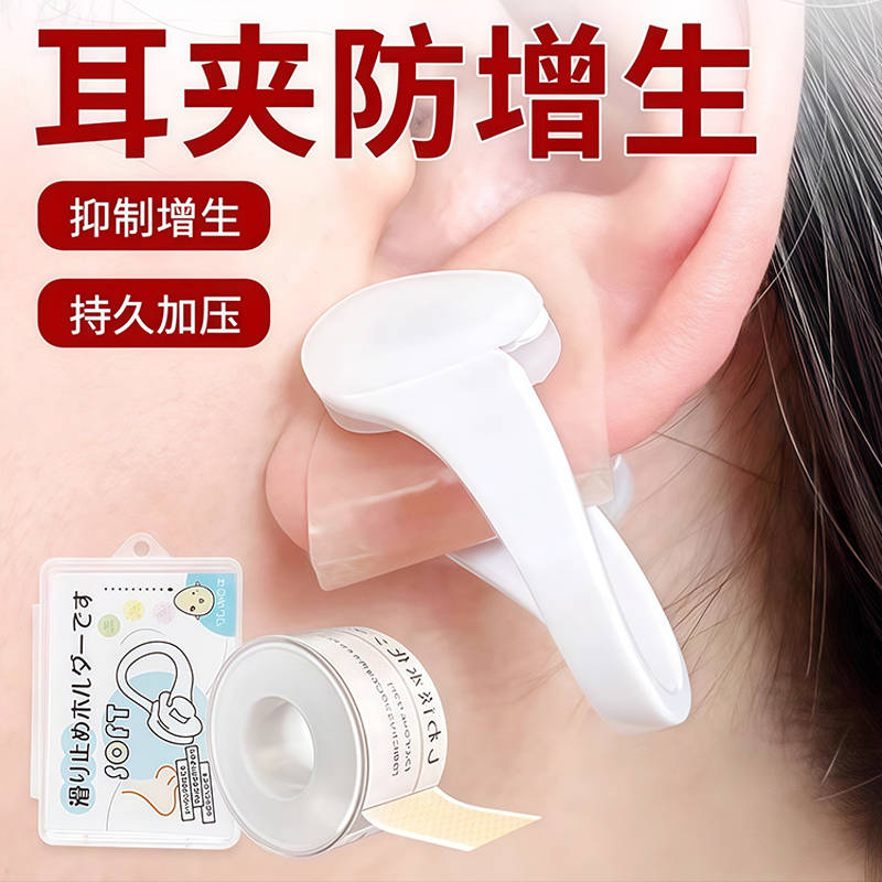 耳夹防增生耳洞耳垂术后防增生疤痕疙瘩压力贴/夹凸起去除疙瘩