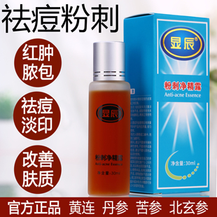 显辰粉刺净精露祛痘精华液控油淡化痘印去闭口青春痘痤疮姨妈痘