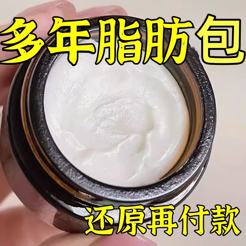 脂肪康皮下消瘤药膏去除神器蓖麻子特效官方旗舰店专用肿硬块去除