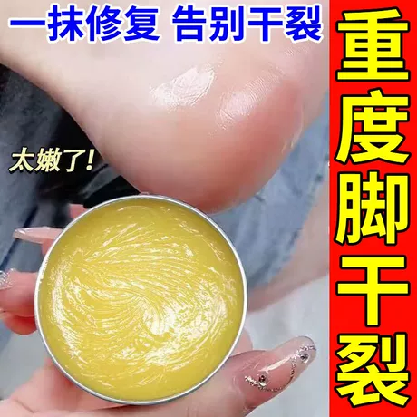 香港脚后跟干裂修复霜手足龟裂开裂治起皮去死皮润马油皱裂膏,医疗器械,保健理疗,淘宝优惠券,粉丝福利购,淘宝优惠卷