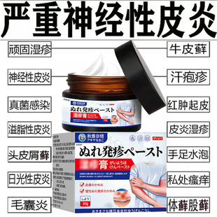 日本顽固皮肤湿疹止痒外用皮炎阴囊肛周去湿痒根干燥痒抑菌软药膏