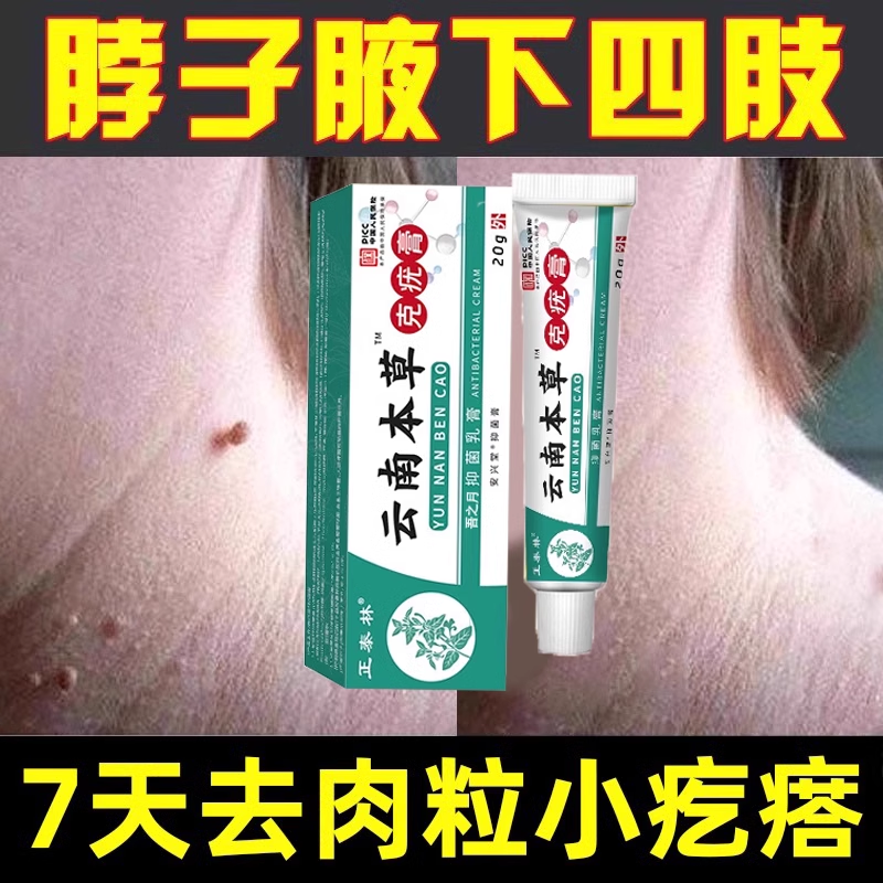 【买2送1】脖子上小肉粒肉刺疙瘩草本去除软膏去除小球球