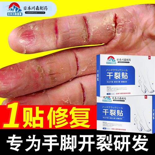 日本手脚干裂贴手足裂口愈合专用胶布手指皲裂防裂护脚后跟保护套
